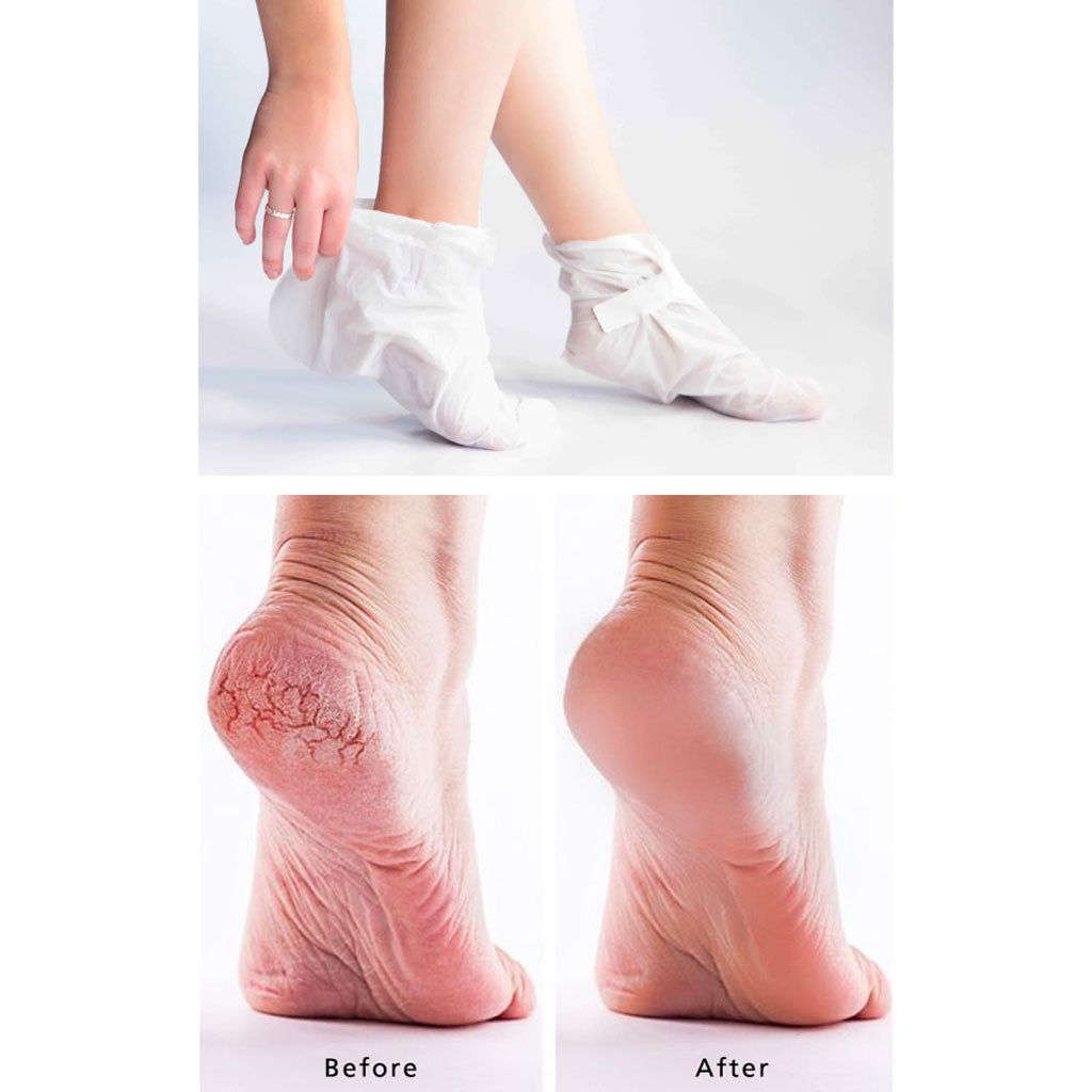 Foot Peel Mask